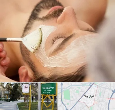 فیشیال صورت آقایان در تهران ویلا