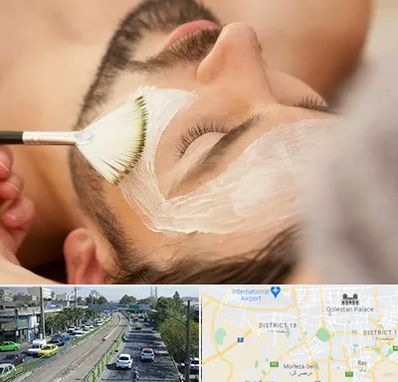 فیشیال صورت آقایان در جنوب تهران