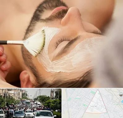 فیشیال صورت آقایان در سیدی مشهد