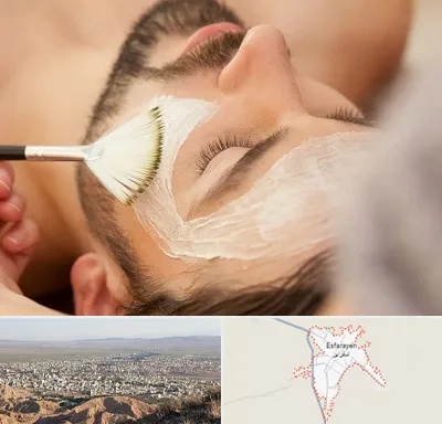 فیشیال صورت آقایان در اسفراین
