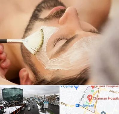 فیشیال صورت آقایان در اقدسیه