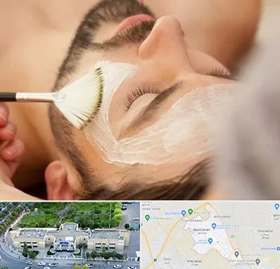 فیشیال صورت آقایان در نسیم شهر