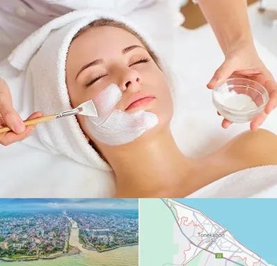فیشیال پوست در تنکابن
