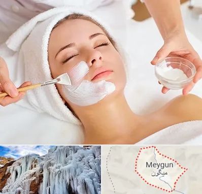 فیشیال پوست در میگون