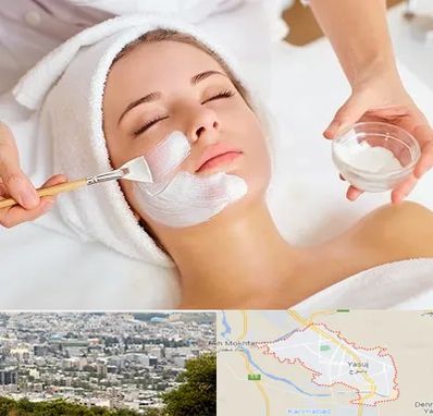 فیشیال پوست در یاسوج