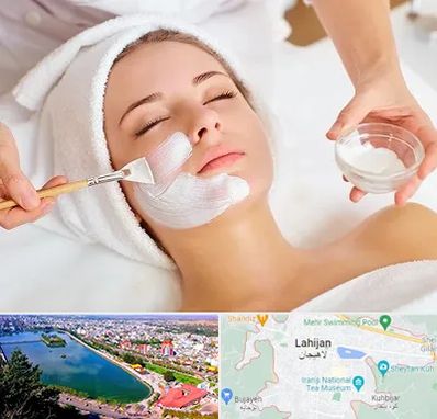 فیشیال پوست در لاهیجان