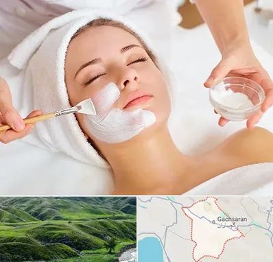 فیشیال پوست در گچساران