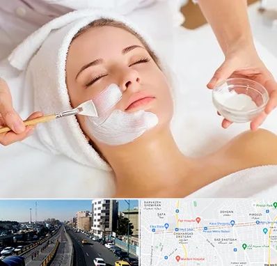 فیشیال پوست در پیروزی