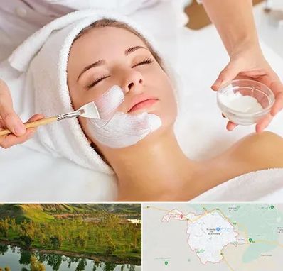 فیشیال پوست در بهبهان
