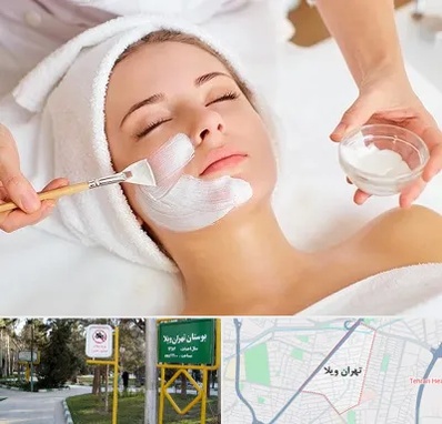 فیشیال پوست در تهران ویلا
