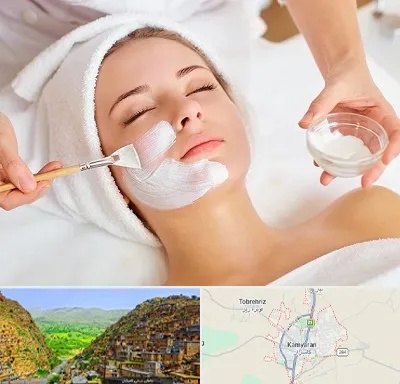 فیشیال پوست در کامیاران