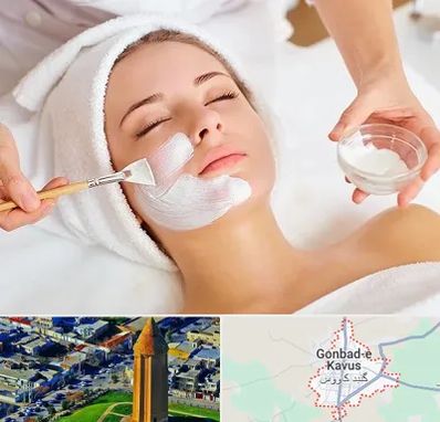 فیشیال پوست در گنبد کاووس