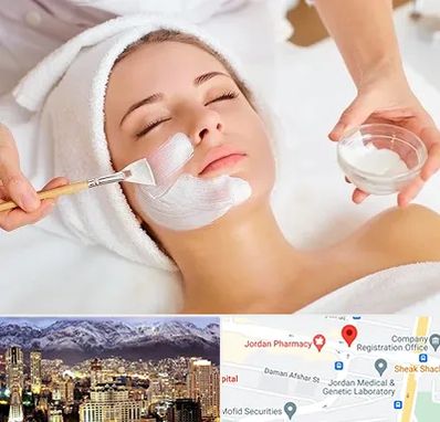 فیشیال پوست در جردن