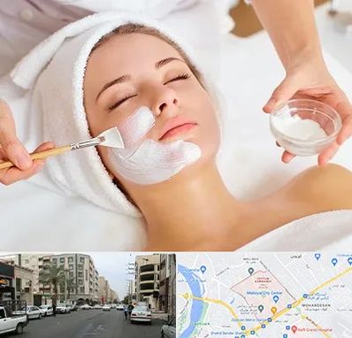 فیشیال پوست در زیتون کارمندی اهواز