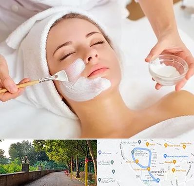 فیشیال پوست در فلکه گاز رشت