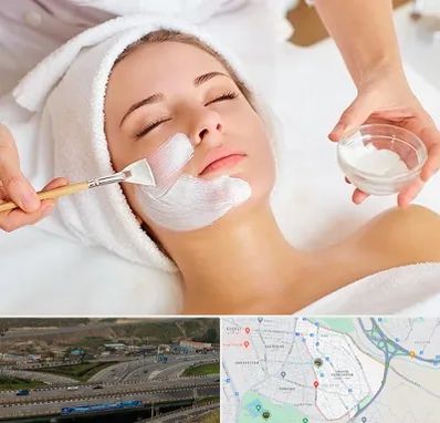 فیشیال پوست در یاغچیان تبریز