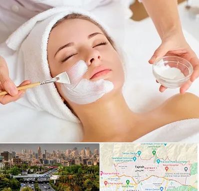 فیشیال پوست در منطقه 1 تهران