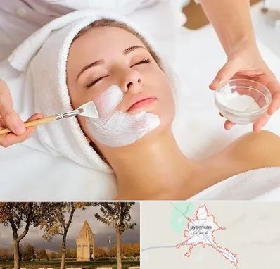 فیشیال پوست در تویسرکان