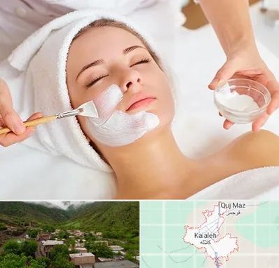 فیشیال پوست در کلاله