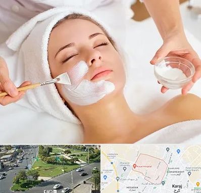 فیشیال پوست در شاهین ویلا کرج