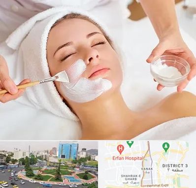 فیشیال پوست در ونک