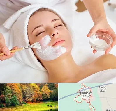 فیشیال پوست در کردکوی