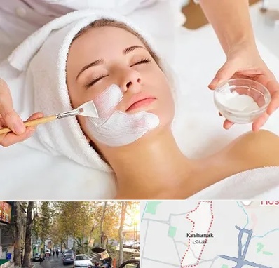 فیشیال پوست در کاشانک