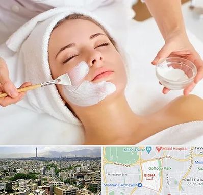 فیشیال پوست در گیشا