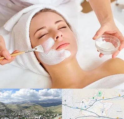فیشیال پوست در رودهن