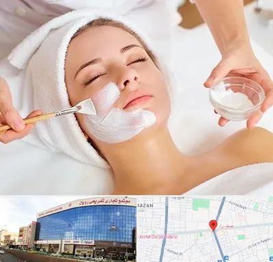 فیشیال پوست در نصف راه تبریز