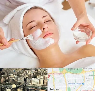 فیشیال پوست در مرزداران