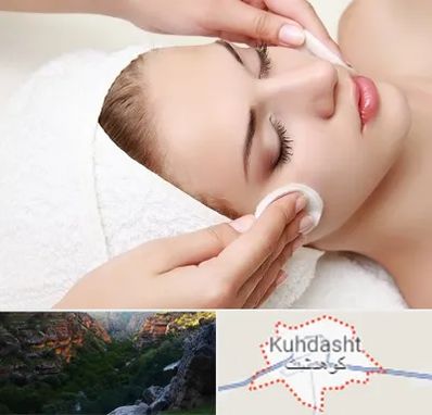 مرکز فیشیال در کوهدشت