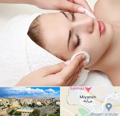 مرکز فیشیال در میانه