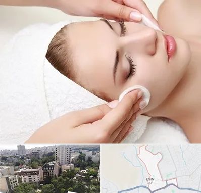 مرکز فیشیال در اوین