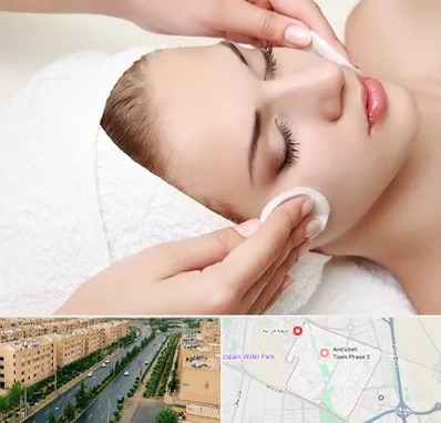 مرکز فیشیال در فاز سه اندیشه