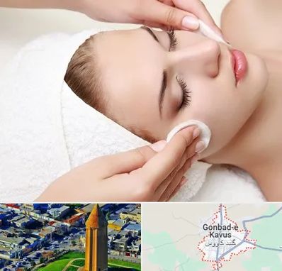 مرکز فیشیال در گنبد کاووس