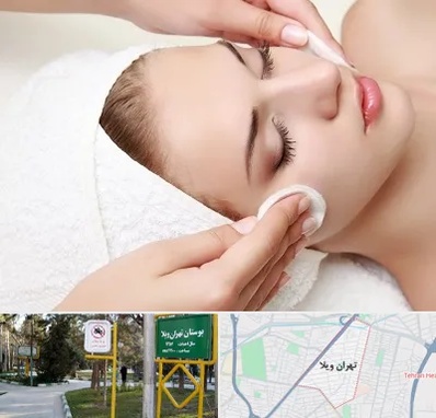 مرکز فیشیال در تهران ویلا