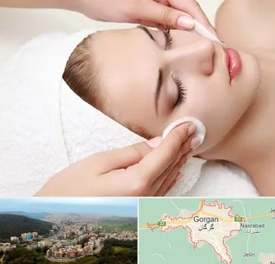 مرکز فیشیال در گرگان