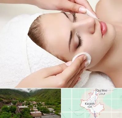 مرکز فیشیال در کلاله
