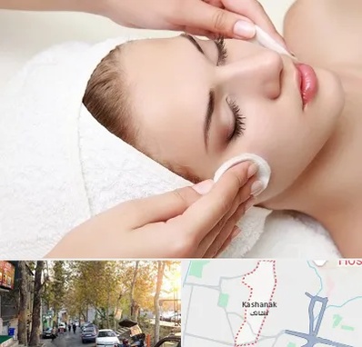 مرکز فیشیال در کاشانک