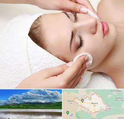 مرکز فیشیال در مرند