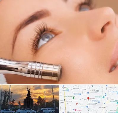 میکرودرم در میدان حر 