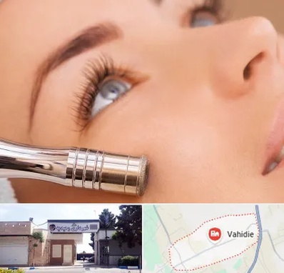 میکرودرم در وحیدیه شهریار