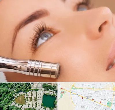 میکرودرم در وکیل آباد مشهد