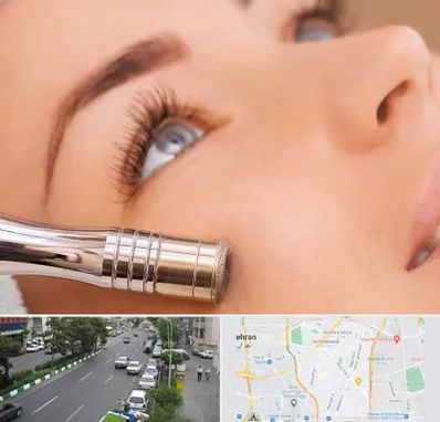 میکرودرم در ستارخان 