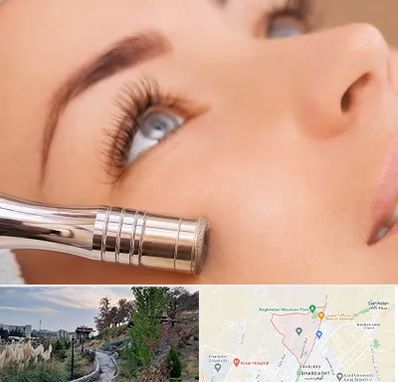 میکرودرم در باغستان کرج