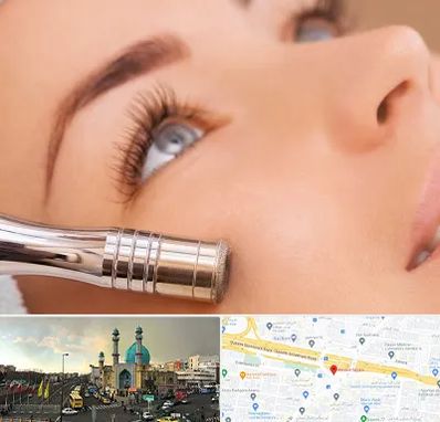 میکرودرم در رسالت 