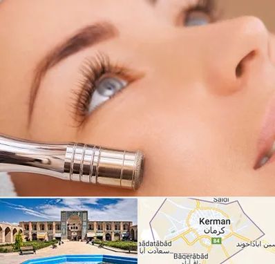 میکرودرم در کرمان