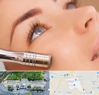 میکرودرم در نسیم شهر