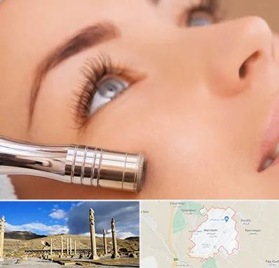 میکرودرم در مرودشت